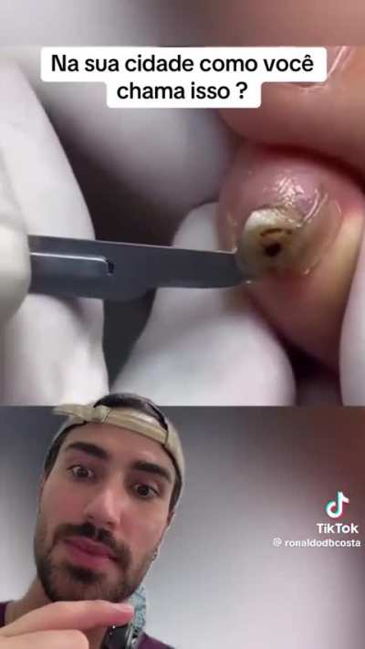 Weird