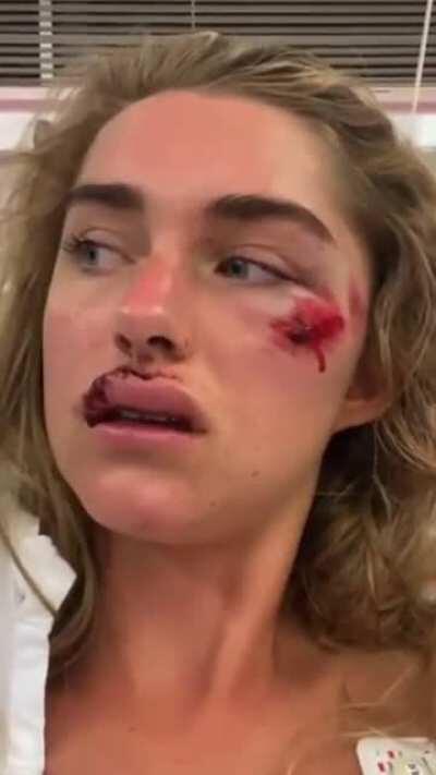 Attempt to skate down an asphalt hill as an amateur