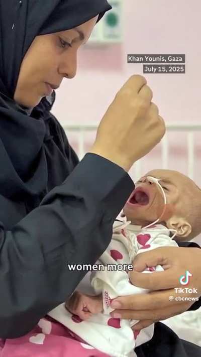 Nurse describes working in Gaza