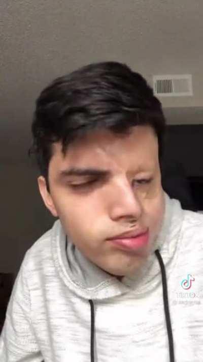 There's no saving face after that