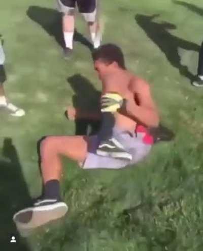 he broke his fucking leg bro