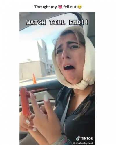 I took my tongue out! (dental sedation)