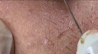 The saga still continues