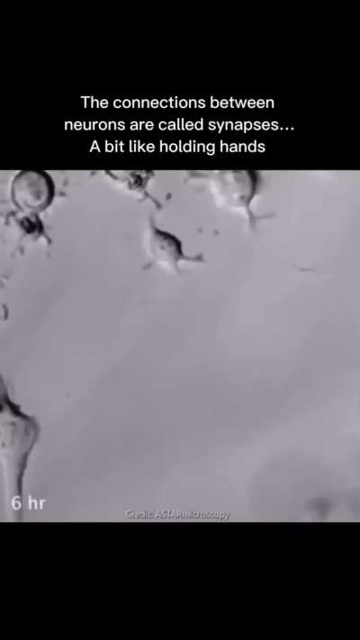 Me at midnight, crying over for a neuron 🤧