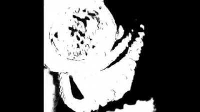 Here is some exclusive fo yall. Alien autopsy. Go thank sunny2point0 fo dis