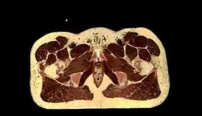 MRI scan of the entire human body