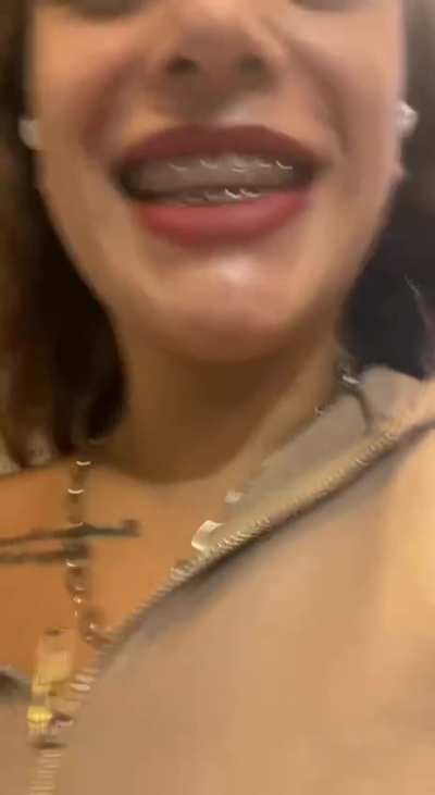 I'm getting my adjustment now, I'll be ditching my pink rubber bands for a month...