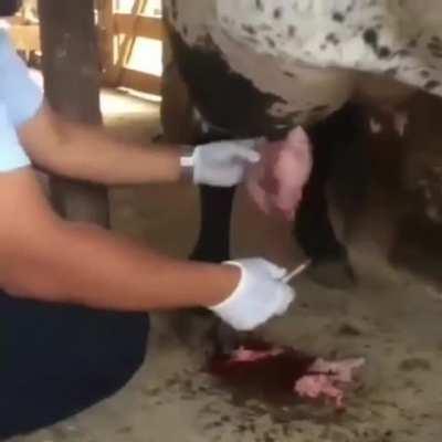 Just the amount of abscess