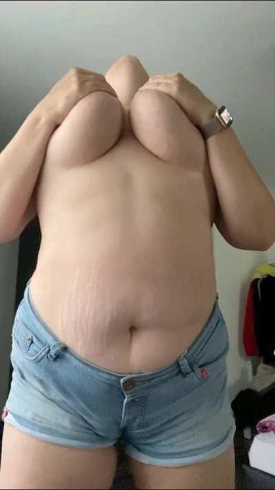 Don't you mind my stretch marks?