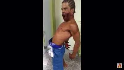 This dude is either high on bath salts or possessed!