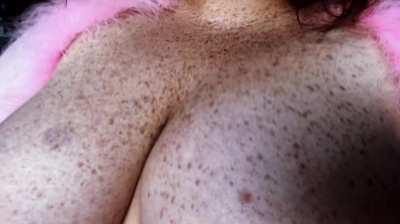 Completely unfiltered video of my chest! Since they are pretty dark, I usually smooth them/add a lightning filter to colour balance everything. More of me in the comments 💕