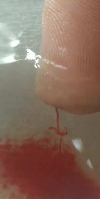 This bowl of water became a natural ECG monitor when I accidentally chopped off the tip of my finger