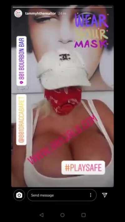 @tammyhtherealtor Tammy Hernandez. 4,200 saline expander breast implants