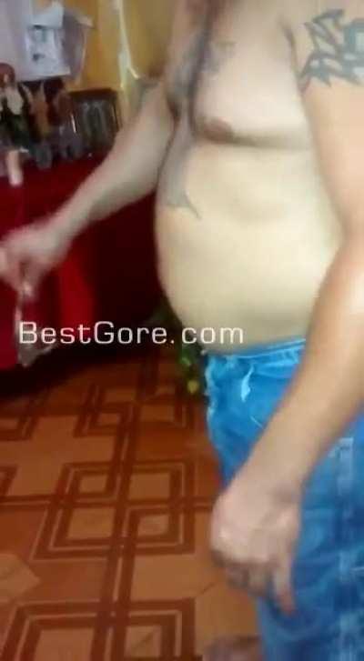 [NSFW] Dead frog extracted from women's vagina.