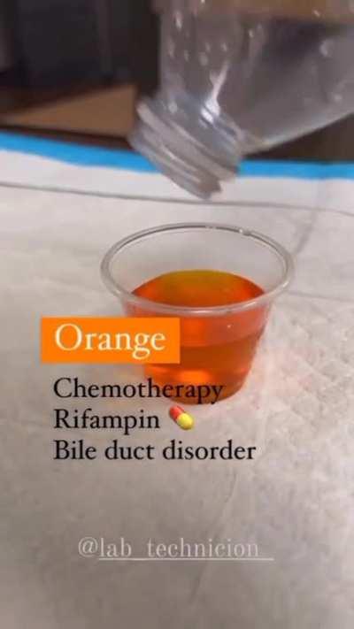 What your Urine color says about your health