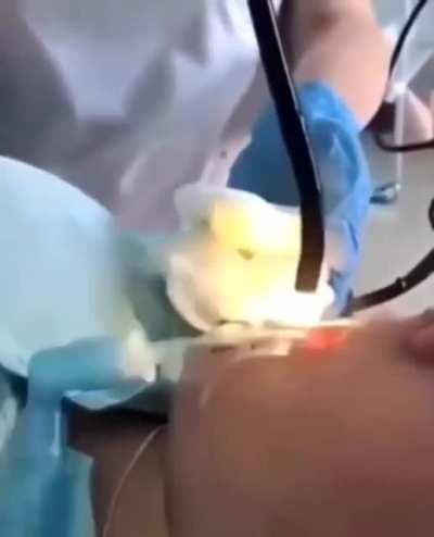 Medics pull 4ft snake from woman’s mouth after it slithered down there while she slept.