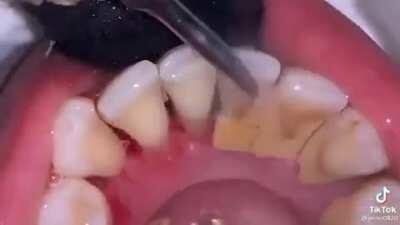 Is it Wednesday yet!?