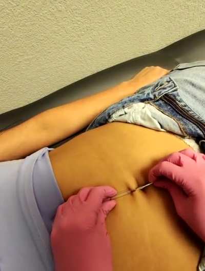 Belly button piercing pt 2