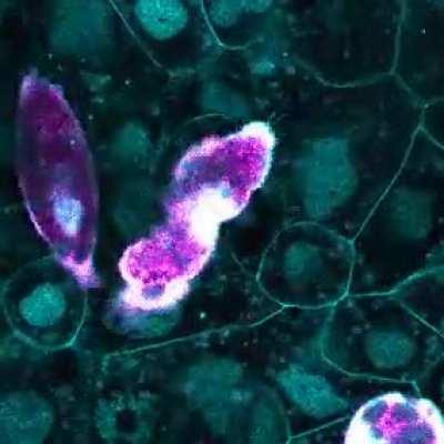 A very squeezy macrophage (in purple) carefully maneuvering through a dense tissue (in blue). Macrophages have adapted to allow them to reach every corner of the body, they can squeeze, they can branch, they can extend pseudopods, all to allow them to pro