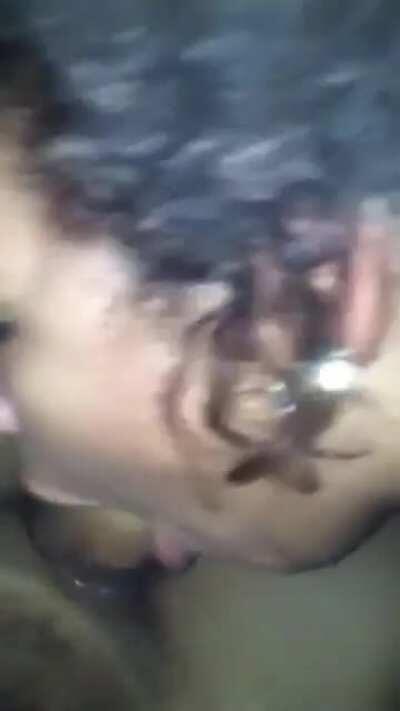 Light skin throat 🤧