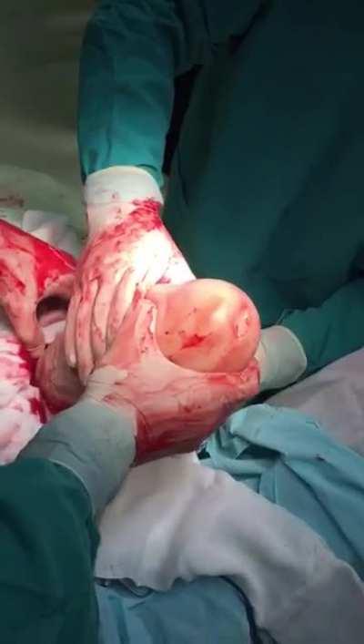 Some got pretty huge & thick appitite....