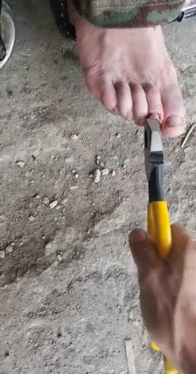 This hurt me more than it did him.