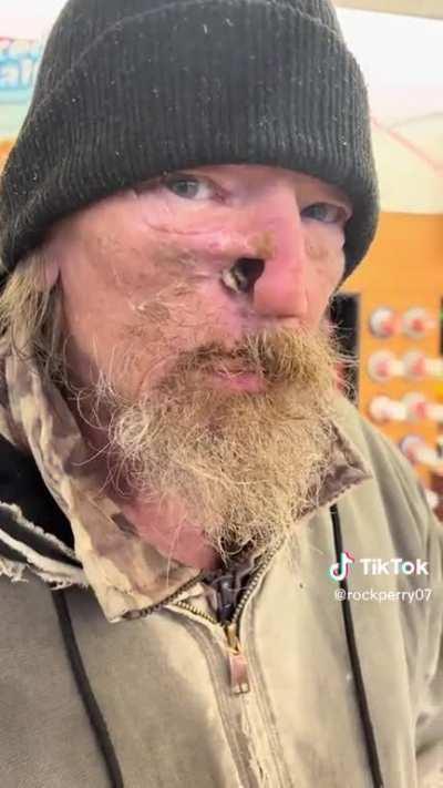 A tweakers nose has left the building