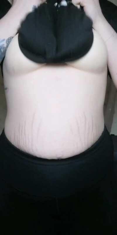 I hope you don't mind my stretch marks