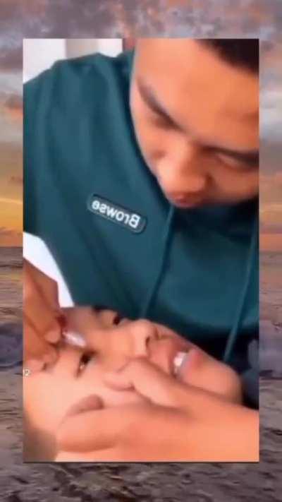 No actual pain involved but still very uncomfortable to watch