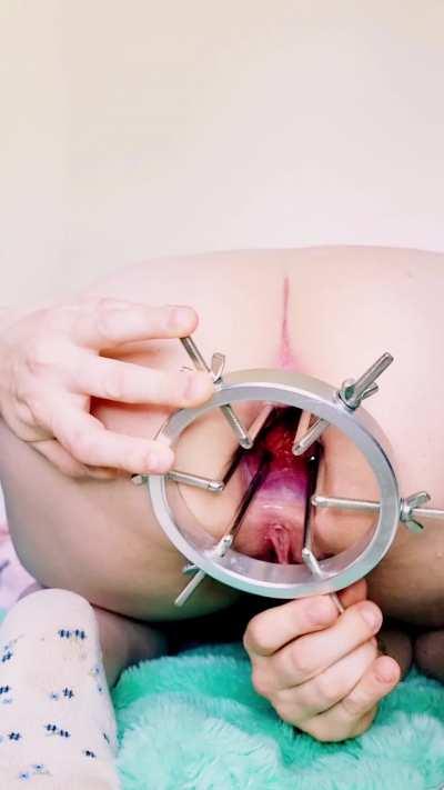 My anal expander adventure 