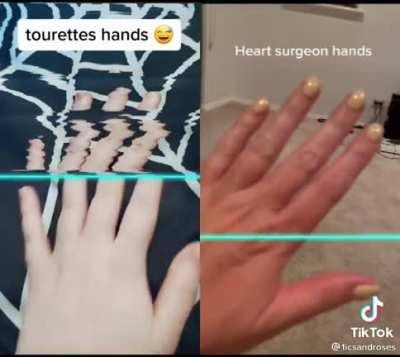 So weird that the hand holding the phone is perfectly still