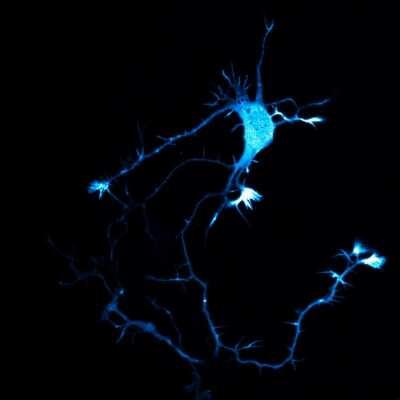 Growth of an embryonic neuron. This rat neuron is deciding which of its processes will become dendrites and which will become its axon.
