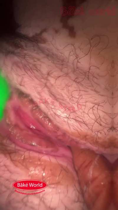 Vitiligo baby sho us why cookies n cream the best candy for trick or treating n bake world