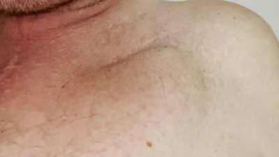 How you know the battery has run down on your pacemaker… (sound on)