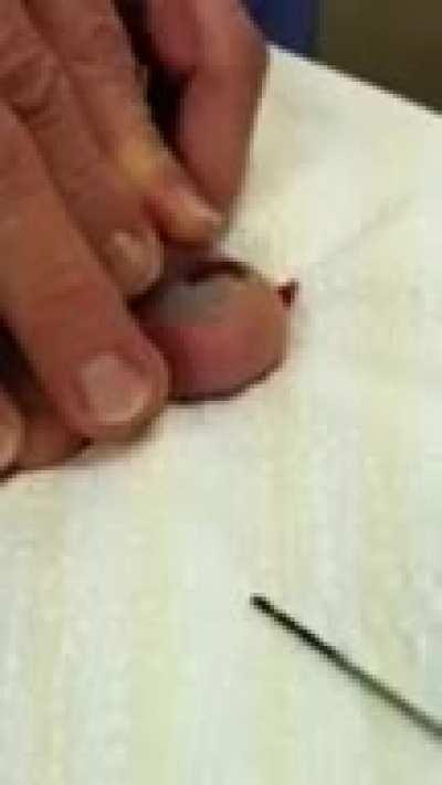 Moment of pain- then relief