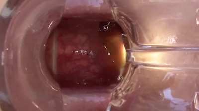 Looking Inside Her Bum