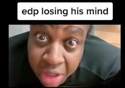 Wtf happens to his hair? Bro looks like he’s on crack