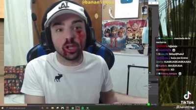 el accidente del papu :v