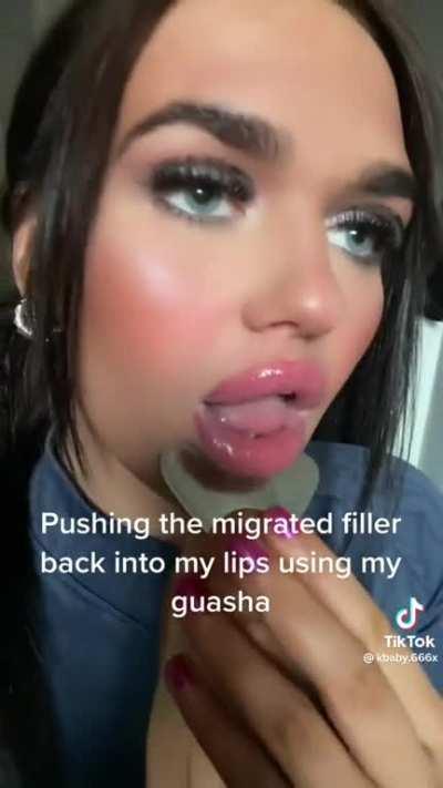 Thanks, I hate loose lip fillers