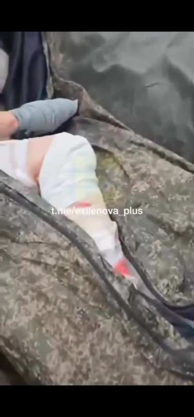 A video of the deminer 