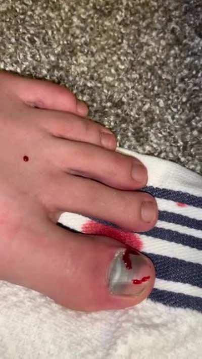 Smashed my toe moving...