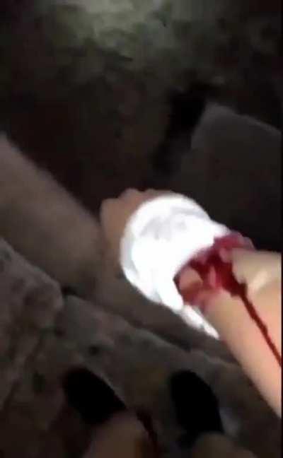 Bystander getting shot by rubber bullet in close range