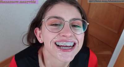 Improving a perfect smile