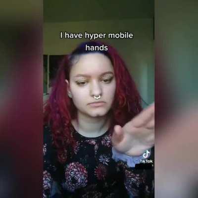 lmao that’s NOT hypermobility…pretty sure most ppl can do this anyway