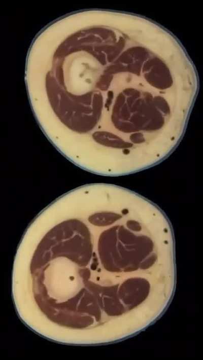 Cross Sections Through a Female Human Body