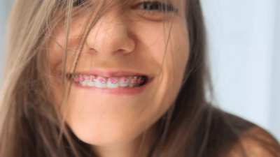 Do you think i'm sexy with braces ?