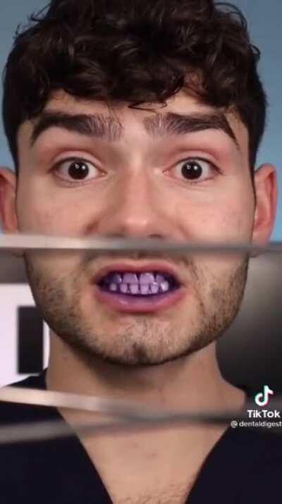 Amogus teethe 😳🥶🥵