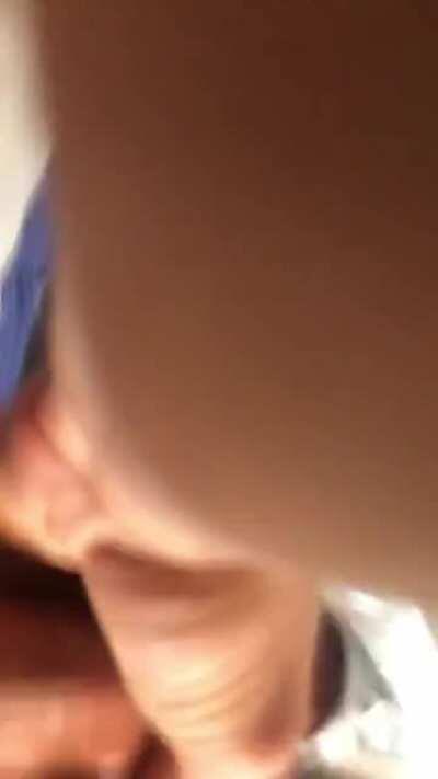 Gomco clamp in action