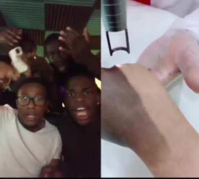 Blursed tattoo Removal