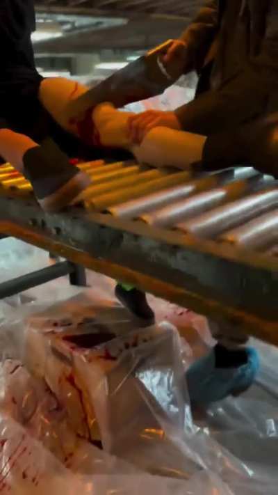 leg amputation IG 10.6.25